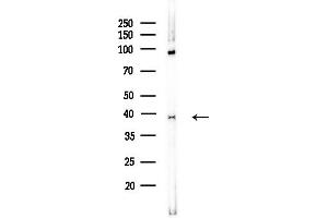 anti-Replication Factor C (Activator 1) 4, 37kDa (RFC4) (Internal Region) antibody