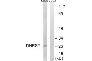 Western blot analysis of extracts from COLO cells, using DHRS2 antibody. (DHRS2 antibody)