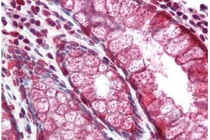 Human Colon (formalin-fixed, paraffin-embedded) stained with MUC2 antibody ABIN334258 at 5 ug/ml followed by biotinylated anti-mouse IgG secondary antibody ABIN481714, alkaline phosphatase-streptavidin and chromogen. (MUC2 antibody)