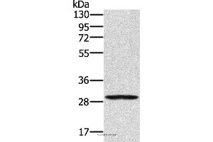 Western blot analysis of 293T cell, using EDA2R Polyclonal Antibody at dilution of 1:250 (Ectodysplasin A2 Receptor antibody)