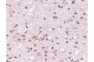 Immunohistochemistry of Ambra1 in human brain with Ambra1 antibody at 5 μg/ml. (AMBRA1 antibody  (N-Term))