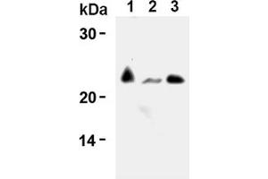Western Blotting (WB) image for anti-CD3 (CD3) antibody (ABIN567797) (CD3 antibody)