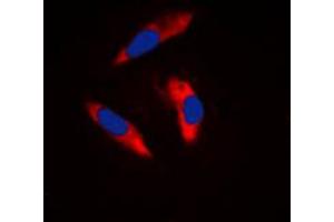 Immunofluorescence (IF) image for anti-Integrin beta 3 (ITGB3) (C-Term) antibody (ABIN7296050)