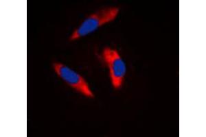 Immunofluorescent analysis of CD61 staining in Raw264. (Integrin beta 3 antibody  (C-Term))