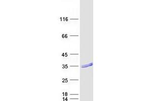 RAB37 Protein (Transcript Variant 2) (Myc-DYKDDDDK Tag)