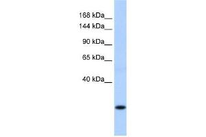 SSX8 antibody used at 0. (SSX8 antibody  (C-Term))