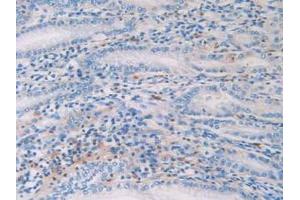 Detection of HIST1H2AG in Human Stomach Tissue using Polyclonal Antibody to Histone Cluster 1, H2ag (HIST1H2AG)