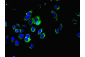 Immunofluorescent analysis of A549 cells using ABIN7159710 at dilution of 1:100 and Alexa Fluor 488-congugated AffiniPure Goat Anti-Rabbit IgG(H+L) (MFAP3L antibody  (AA 29-102))