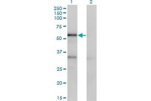 Western Blot analysis of SERPINA10 expression in transfected 293T cell line by SERPINA10 monoclonal antibody (M02), clone 1E11. (SERPINA10 antibody  (AA 22-444))