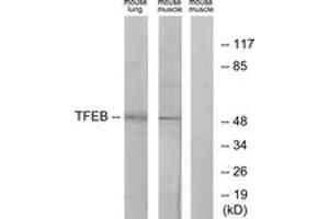 Western blot analysis of extracts from mouse lung/mouse muscle cells, using TFEB Antibody. (TFEB antibody  (AA 10-59))