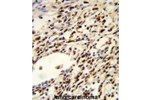Immunohistochemistry (IHC) image for anti-Folliculin (FLCN) antibody (ABIN3003855)