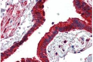 Anti-MMP14 antibody IHC of human lung, respiratory epithelium. (MMP14 antibody  (AA 160-173))