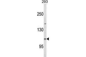 Western blot analysis of ESPN Antibody (N-term) in 293 cell line lysates (35ug/lane).