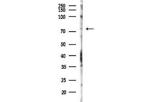anti-Glyceronephosphate O-Acyltransferase (GNPAT) (Internal Region) antibody