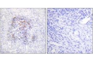 Immunohistochemistry analysis of paraffin-embedded human ovary, using IREB1 (Phospho-Ser138) Antibody. (Aconitase 1 antibody  (pSer138))