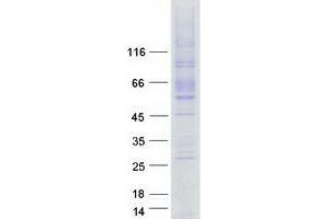LMBRD1 Protein (Myc-DYKDDDDK Tag)