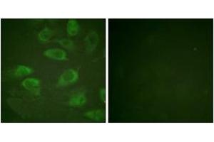 Immunofluorescence analysis of HeLa cells, using IL-2R alpha/CD25 (Phospho-Ser268) Antibody.