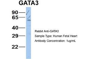Host: Rabbit Target Name: GATA3 Sample Type: Human Fetal Heart Antibody Dilution: 1.