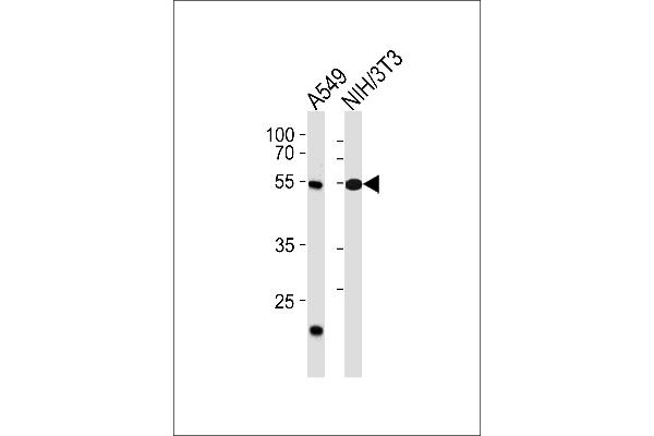 TBX4 antibody  (N-Term)