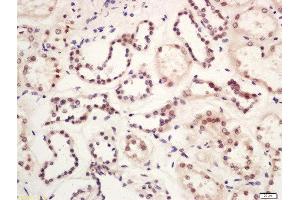 Formalin-fixed and paraffin embedded human kidney labeled with Rabbit Anti-GLIS3 Polyclonal Antibody, Unconjugated (ABIN2174444) at 1:200 followed by conjugation to the secondary antibody and DAB staining (GLIS3 antibody  (AA 101-200))