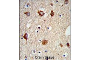 Formalin-fixed and paraffin-embedded mouse brain tissue reacted with MAP2 Antibody, which was peroxidase-conjugated to the secondary antibody, followed by DAB staining. (MAP2 antibody)