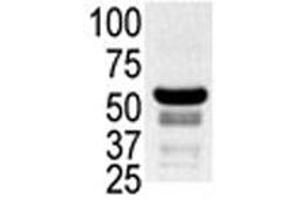 Western blot testing of ovary lysate with PAK2 antibody. (PAK2 antibody  (AA 192-222))