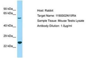 Image no. 1 for anti-Chromosome 3 Open Reading Frame 58 (C3ORF58) (AA 85-134) antibody (ABIN6749934) (C3orf58 antibody  (AA 85-134))