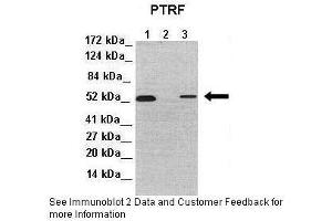 Western Blotting (WB) image for anti-Polymerase I and Transcript Release Factor (PTRF) (Middle Region) antibody (ABIN2779886)