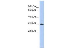 Image no. 1 for anti-Zinc Finger Protein 771 (ZNF771) (AA 35-84) antibody (ABIN6742627)