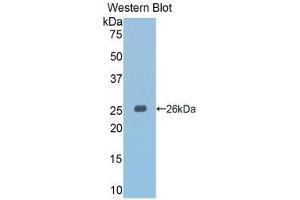 Western Blotting (WB) image for anti-Slit Homolog 3 (SLIT3) (AA 1348-1517) antibody (ABIN1860583) (SLIT3 antibody  (AA 1348-1517))