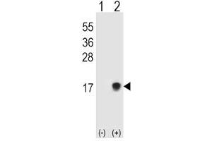 Western blot testing of SUMO2/3 antibody and 293T cell lysate either nontransfected (Lane 1) or transiently transfected (Lane 2) with the SUMO3 gene. (SUMO2/3 antibody  (AA 49-81))