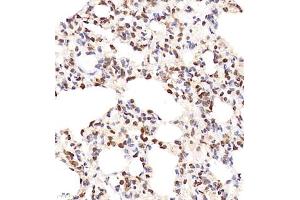 Immunohistochemistry of paraffin embedded rat lung using SHF-1 (ABIN7075710) at dilution of 1:600 (400x lens) (SHF antibody)