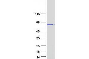 VPS72 Protein (Myc-DYKDDDDK Tag)