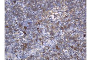 Image no. 1 for anti-Mast/stem Cell Growth Factor Receptor (KIT) (AA 546-976) antibody (ABIN1491585) (KIT antibody  (AA 546-976))