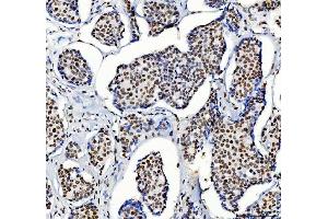 IHC analysis of HDAC2 using anti-HDAC2 antibody (ABIN7601564).