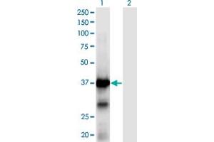Western Blot analysis of XPA expression in transfected 293T cell line by XPA monoclonal antibody (M01), clone 2E4. (XPA antibody  (AA 1-273))