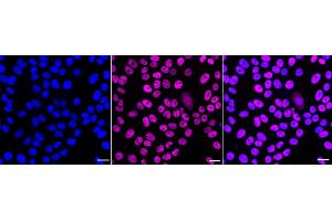 Immunocytochemical staining of HepG2 cells with MBD2 antibody (ABIN7799386), 1:1,000). (Recombinant MBD2 antibody)
