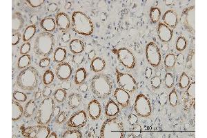 Immunostaining (ISt) image for anti-Acetyl-CoA Acyltransferase 2 (ACAA2) (AA 151-260) antibody (ABIN564548)