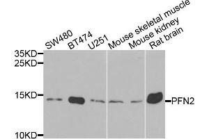 Western blot analysis of extracts of various cells, using PFN2 antibody. (PFN2 antibody)