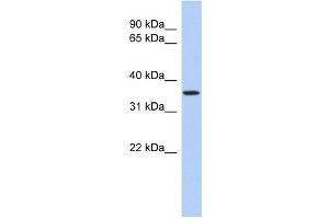 POLR3F antibody used at 1 ug/ml to detect target protein. (POLR3F antibody  (N-Term))