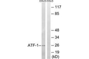 Western blot analysis of extracts from COLO cells, using ATF1 (Ab-63) Antibody. (AFT1 antibody  (AA 31-80))
