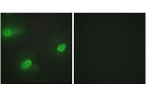 Immunofluorescence analysis of HeLa cells, using CSTF2 Antibody.