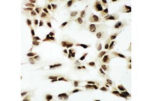 Anti-NRF1 antibody, ICC ICC: A549 Cell (NRF1 antibody  (Middle Region))