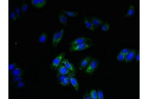 Immunofluorescent analysis of HepG2 cells using ABIN7168900 at dilution of 1:100 and Alexa Fluor 488-congugated AffiniPure Goat Anti-Rabbit IgG(H+L) (SPTLC3 antibody  (AA 1-58))