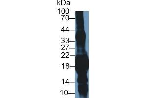 Western Blot; Sample: Mouse Eye lysate; Primary Ab: 1µg/ml Rabbit Anti-Mouse CRYgS Antibody Second Ab: 0. (CRYGS antibody  (AA 2-178))