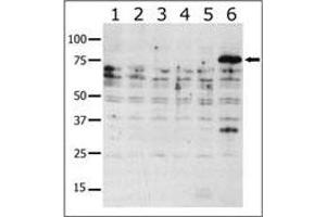 Western blot analysis of anti-K6 b (ABIN392439 and ABIN2842037) in lysates from transiently transfected COS7 cells. (PAK6 antibody  (AA 116-146))