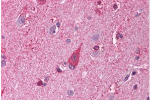 Human Brain, Cortex (formalin-fixed, paraffin-embedded) stained with TLR8 antibody ABIN214003 at 5 ug/ml followed by biotinylated goat anti-rabbit IgG secondary antibody ABIN481713, alkaline phosphatase-streptavidin and chromogen. (TLR8 antibody)