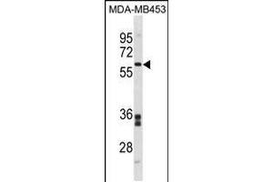 Western blot analysis in MDA-MB453 cell line lysates (35ug/lane). (FMO5 antibody  (C-Term))