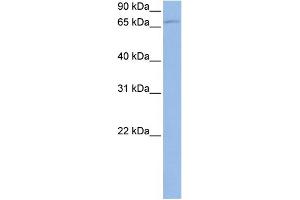 WB Suggested Anti-TBK1 Antibody Titration: 0.
