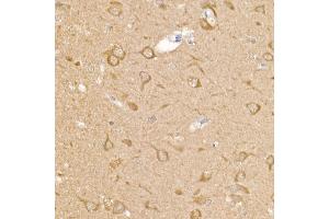 Immunohistochemistry of paraffin-embedded rat brain using RC Rabbit pAb (ABIN6129452, ABIN6146811, ABIN6146812 and ABIN6220955) at dilution of 1:150 (40x lens).